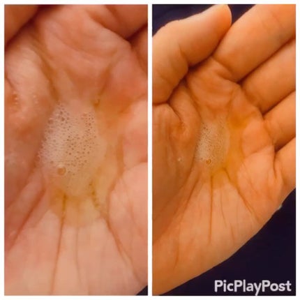 V エッセンス/unlabel/美容液を使ったクチコミ(2枚目)