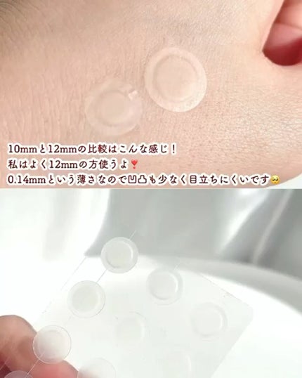 ゼロスポットパッチ/Today’s Cosme/にきびパッチの人気ショート動画