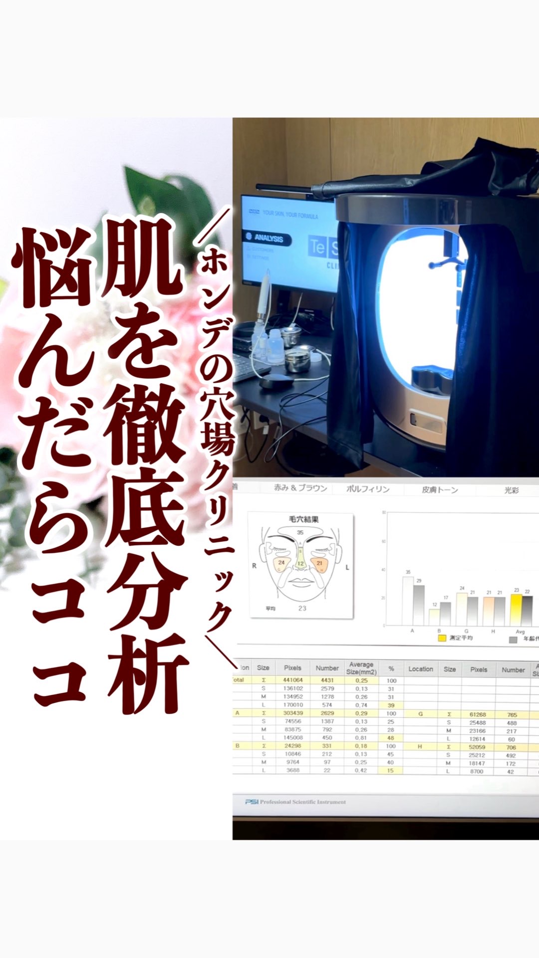 ＼ホンデの穴場クリニック見つけた🇰🇷💉／
.
9月の渡韓でどのクリニック行こうかなって色々探してたんだけど意外と知られてない、テシトクリニック（TeSiTo）に初めて行ってきたよ🏥
.
ここ、ただの美容皮膚科じゃなくて
最初に“肌の