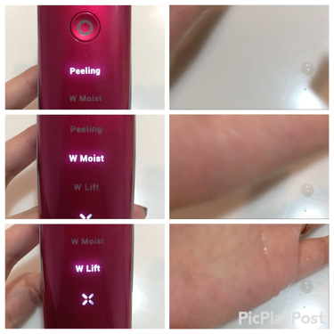 試してみた】アクリアルピーリングプロ COSBEAUTYのリアルな 試してみた】アクリアルピーリングプロ COSBEAUTYのリアルな
