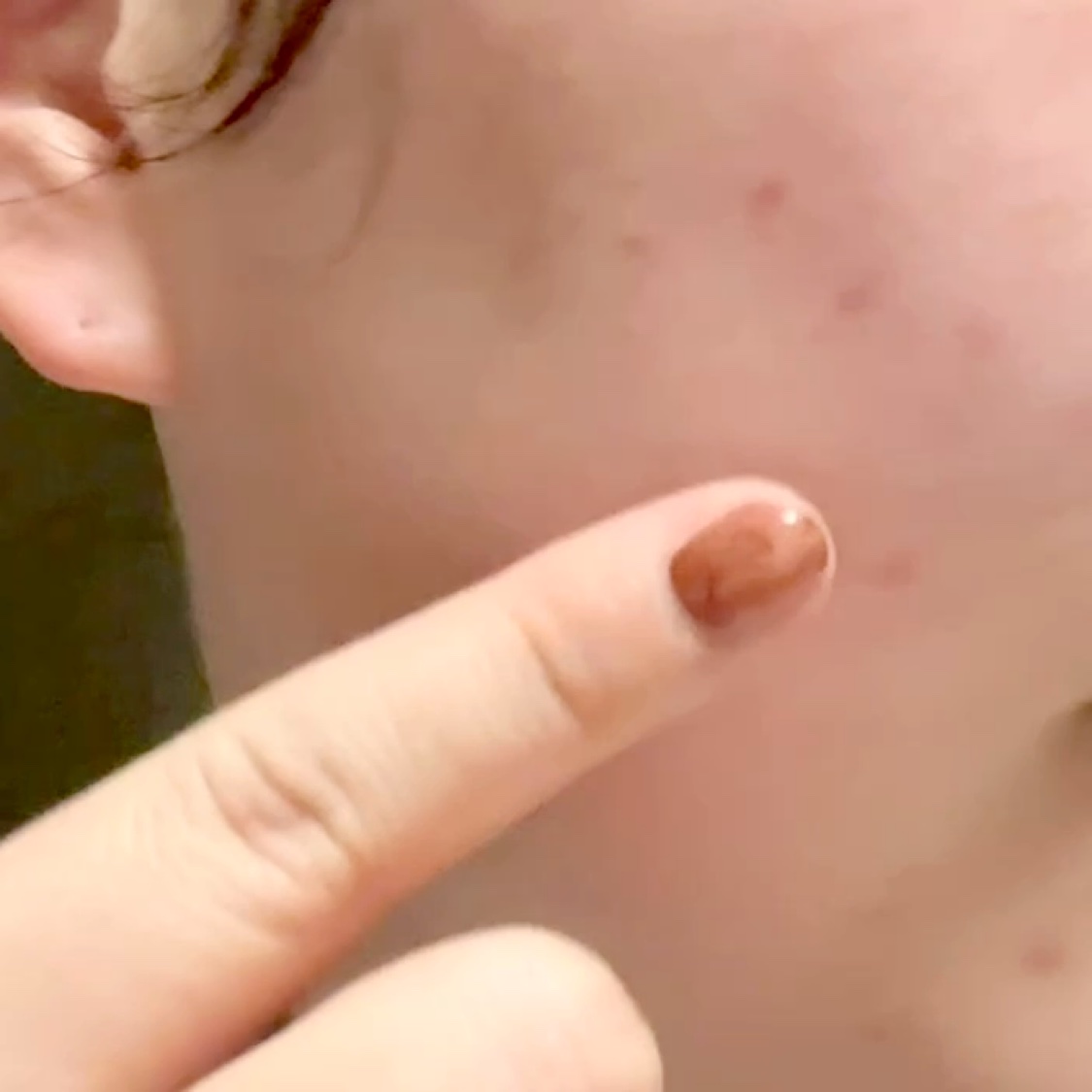 ポアタイトニングコラーゲンアンプル/Biodance/美容液を使ったクチコミ（3枚目）