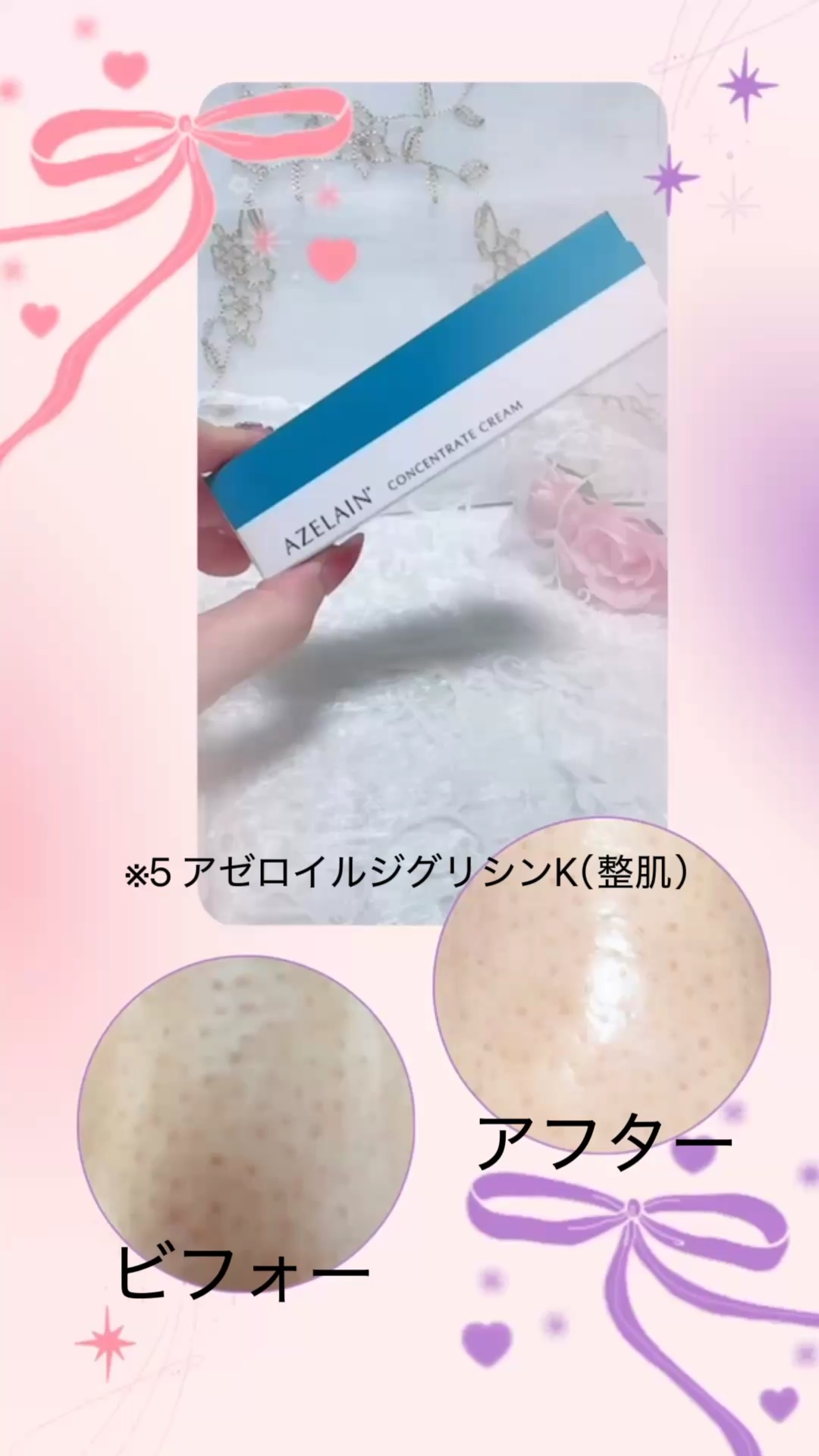 AZLAIN　クリーム　AZコンセントトレートクリーム/AZELAIN/フェイスクリームを使ったクチコミ（1枚目）