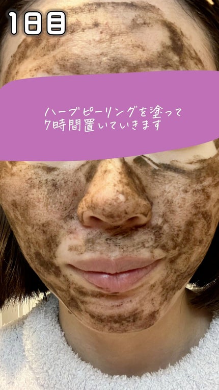 ダーマスキンピーリング/BQCELL/その他キットセットの人気ショート動画