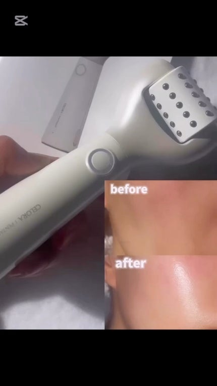 ペンタショット/CELORABY/美顔器・マッサージの人気ショート動画