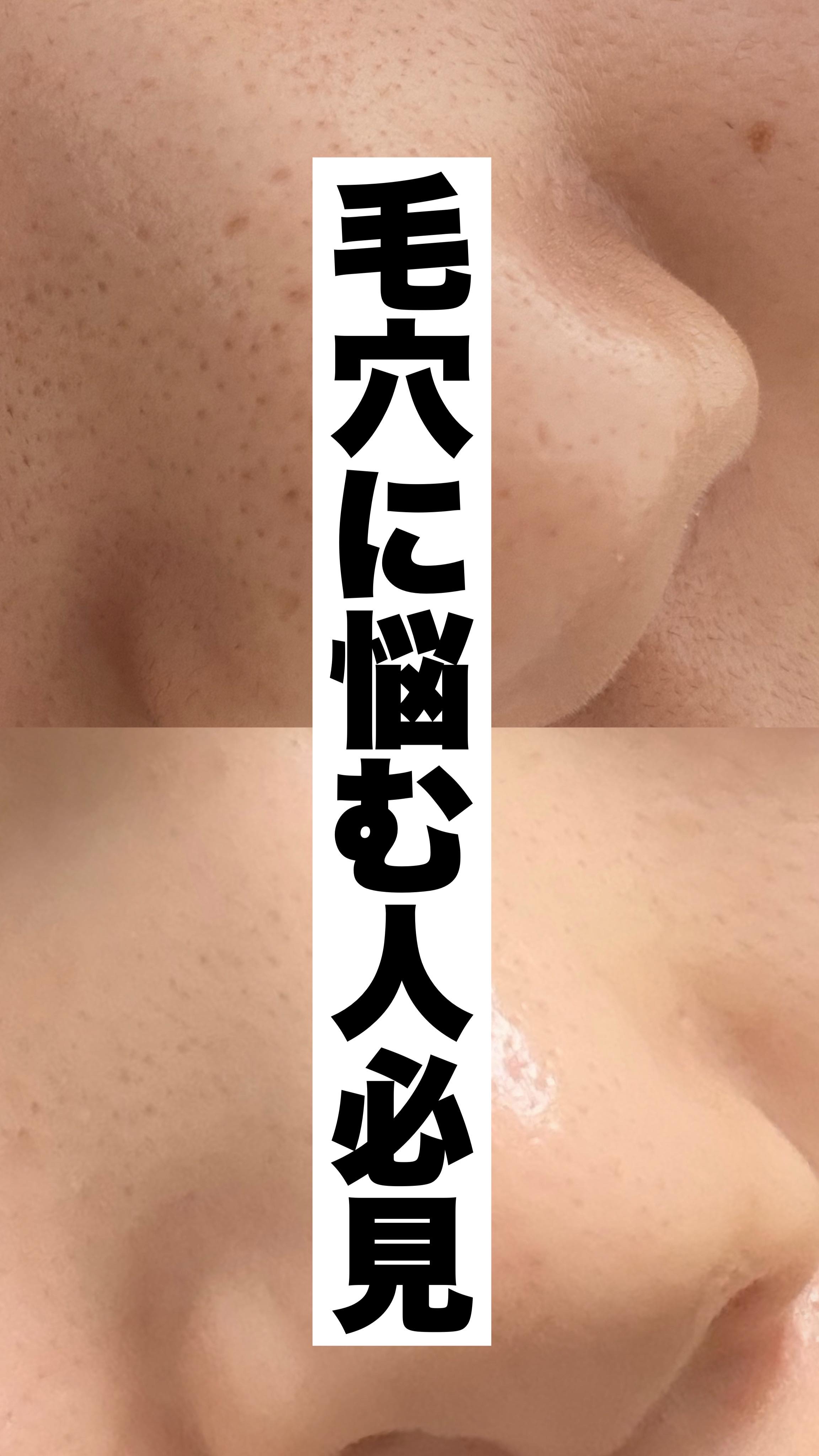 ペンタショット/CELORABY/美顔器・マッサージの人気ショート動画