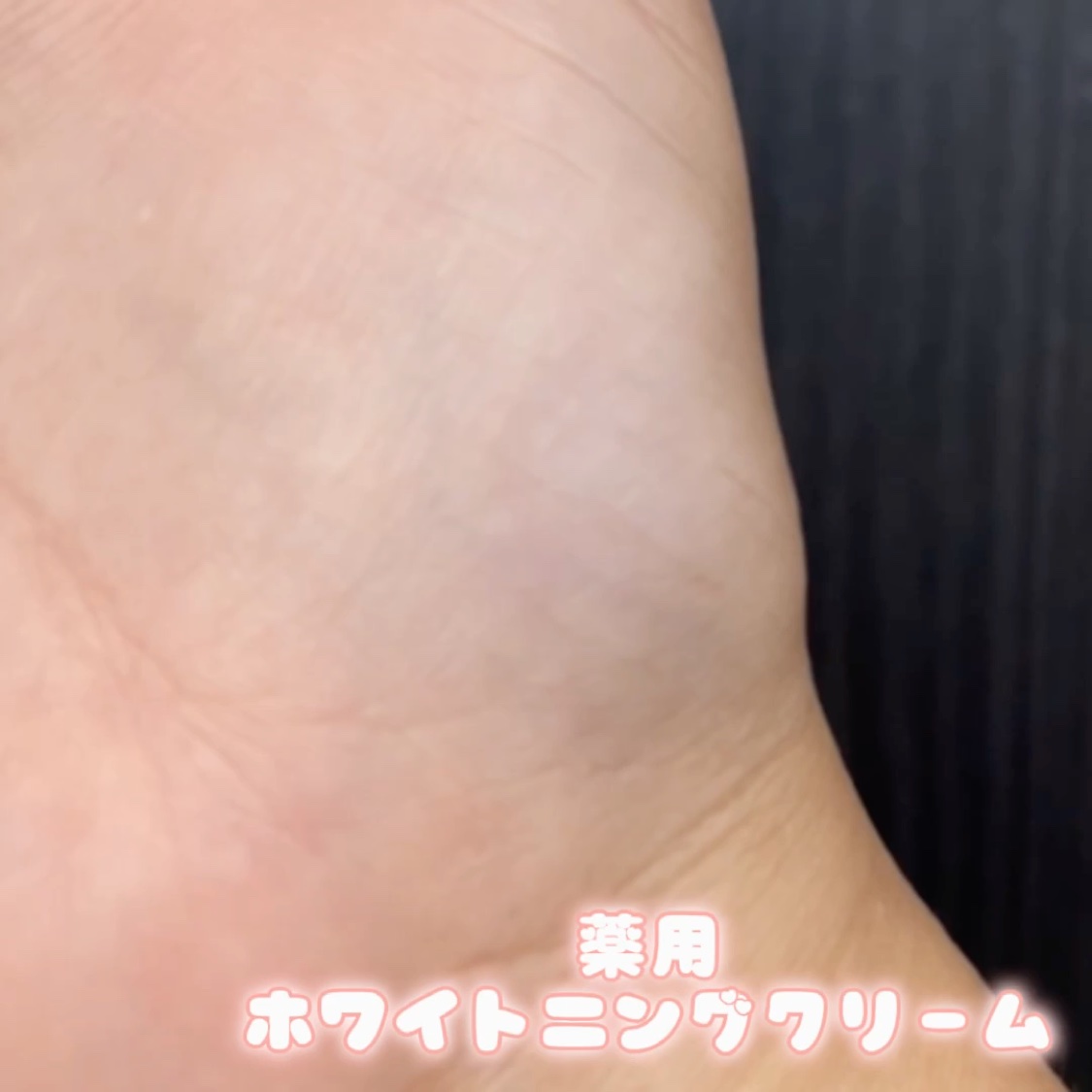 ナキコ 薬用ホワイトニングクリーム/NAKICO/フェイスクリームの動画クチコミ5つ目