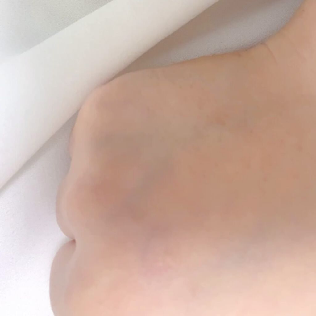 白潤プレミアム 薬用浸透美白化粧水/肌ラボ/化粧水を使ったクチコミ（2枚目）