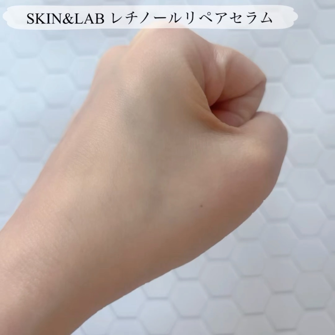 ヴィーガンリポソームレチノールセラム/SKIN&LAB/美容液を使ったクチコミ（2枚目）