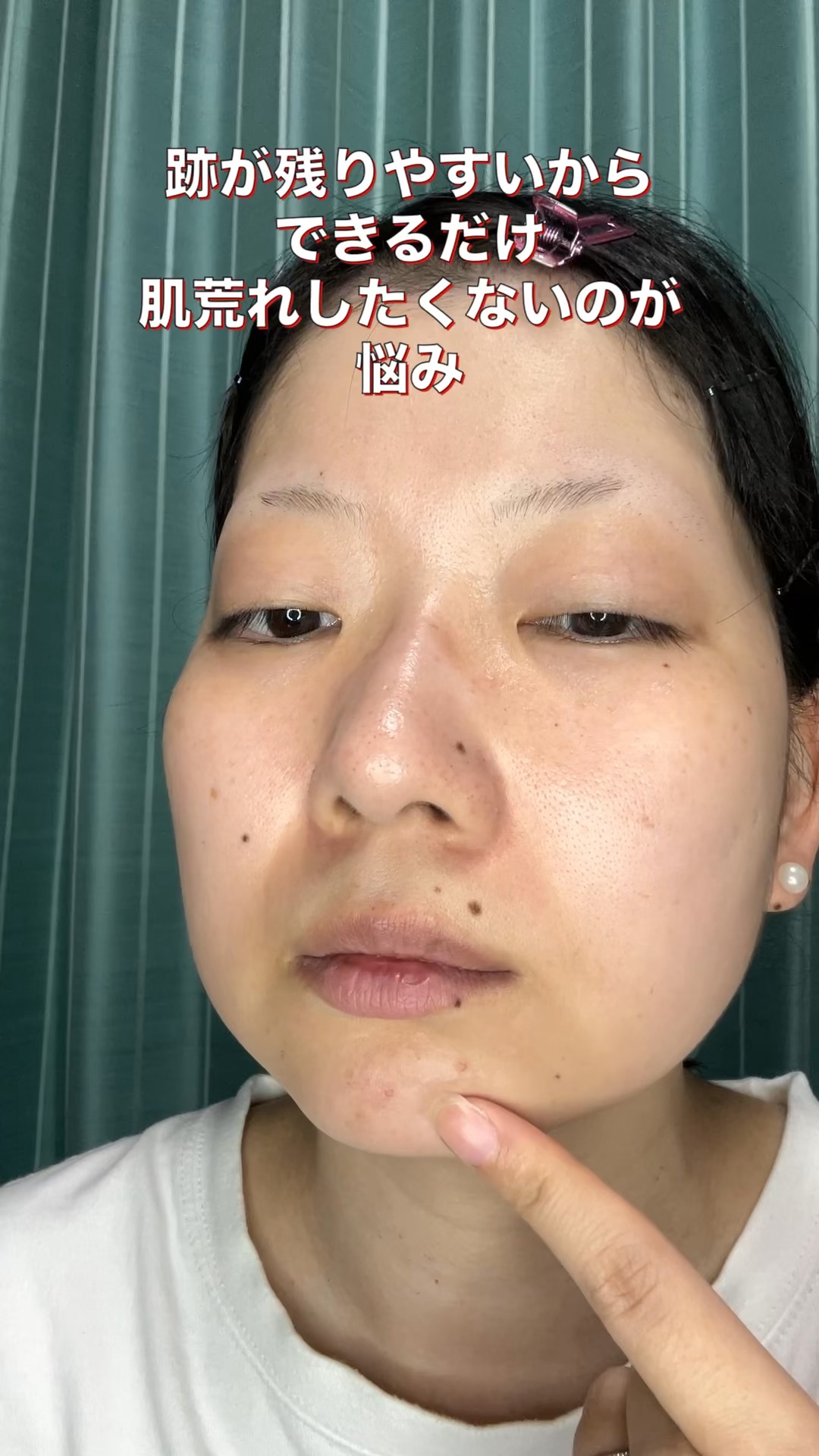 青麦ジンクセラム/Veganifect/美容液の人気ショート動画