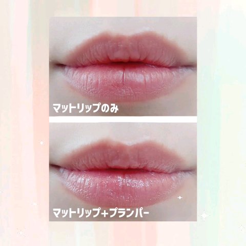 キス　ジェムプランパー/KiSS/リッププランパーを使ったクチコミ（3枚目）