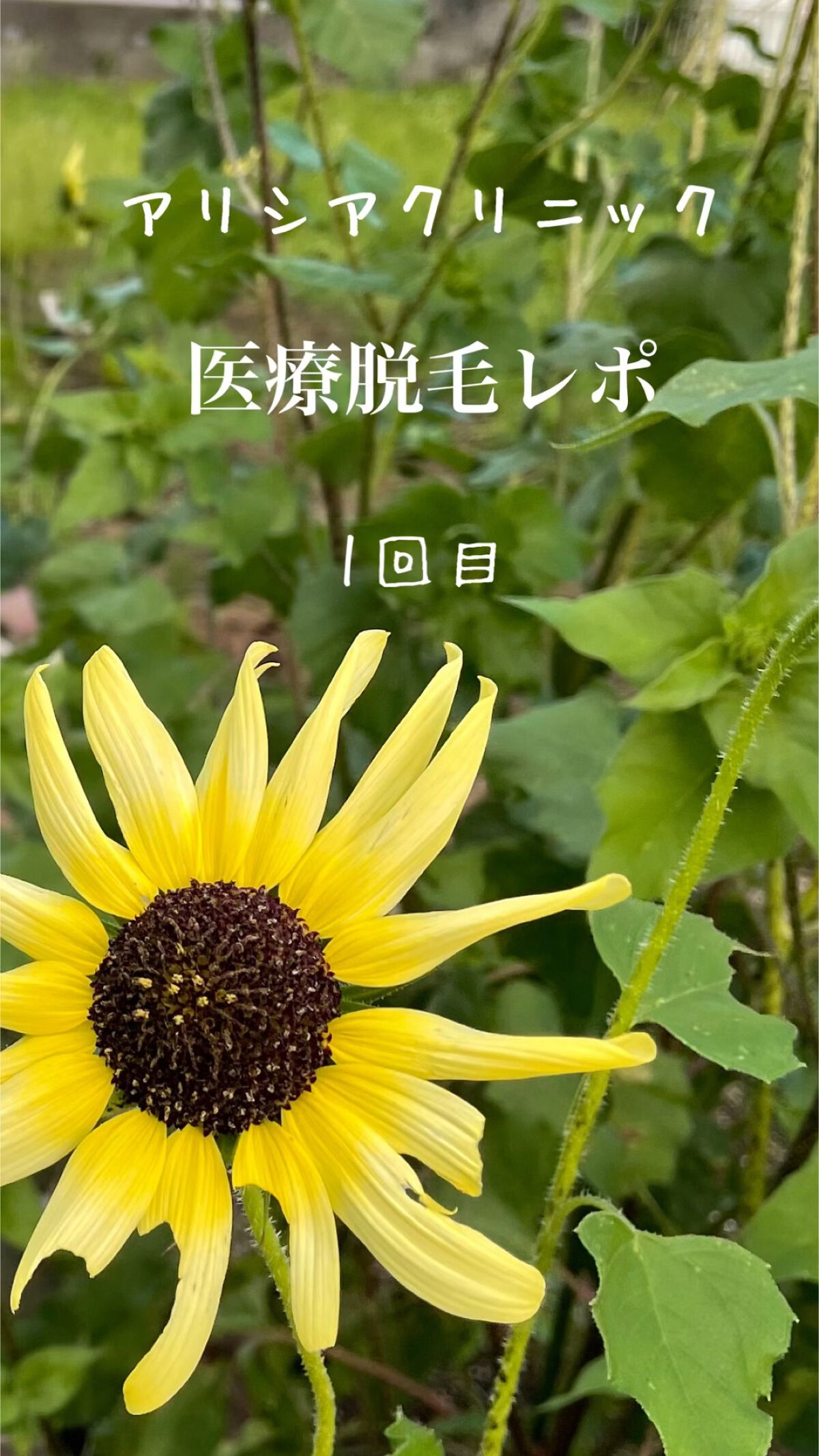 FASIZ607C IPL光脱毛器/FASIZ/家庭用脱毛器の動画クチコミ5つ目