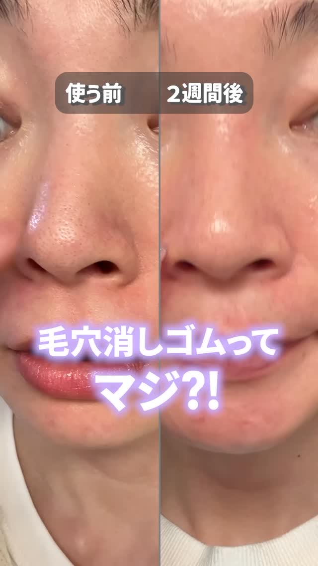 ブースターソニック/Glow.M/美顔器・マッサージの人気ショート動画