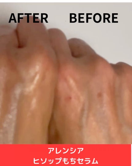 レッドモチセラム30/アレンシア/美容液を使ったクチコミ(3枚目)