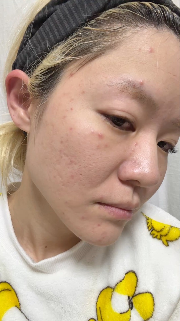 アスタリフト ジェリー アクアリスタ/アスタリフト/美容液を使ったクチコミ（1枚目）