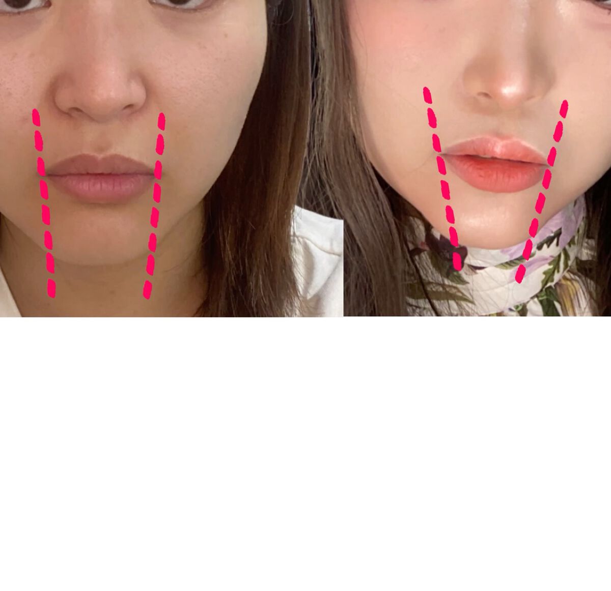 シェーディングパウダー/キャンメイク/シェーディングを使ったクチコミ（2枚目）