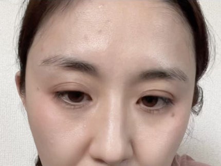 ex アイラッシュセラム/RERUJU(リルジュ)/まつげ美容液を使ったクチコミ(3枚目)