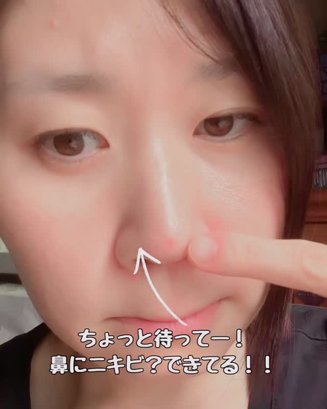 ACマグネシウムパッチ 15個入り/スノーツープラス/シートマスク・パックを使ったクチコミ（1枚目）