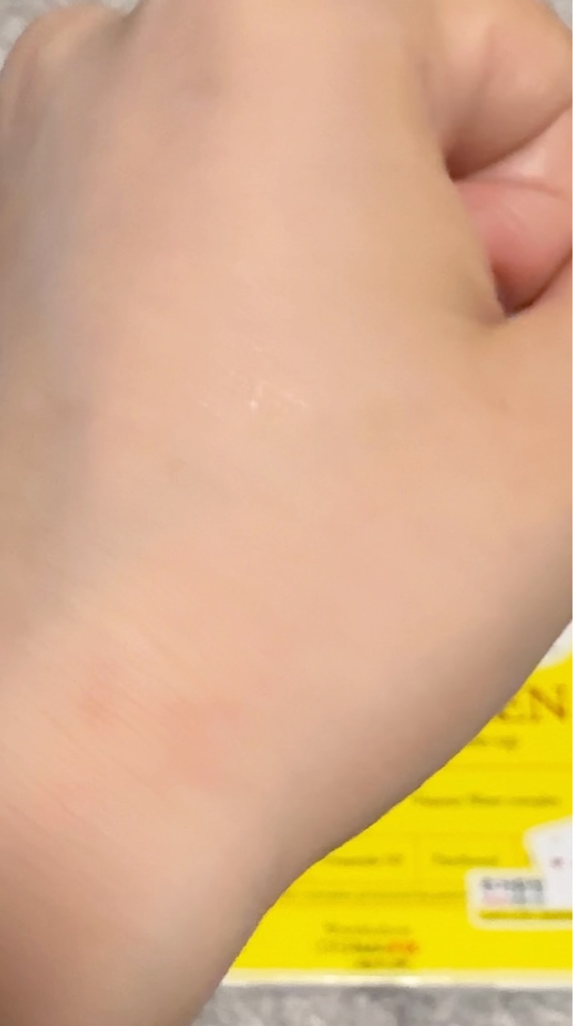 パーフェクト リアル パフォーマンス ヒアルコラーゲ ンマスクパック /ダーマフィックス/シートマスク・パックの動画クチコミ3つ目