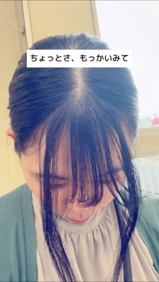 グローターン 100ml/リリーイブ/頭皮ローションを使ったクチコミ（1枚目）