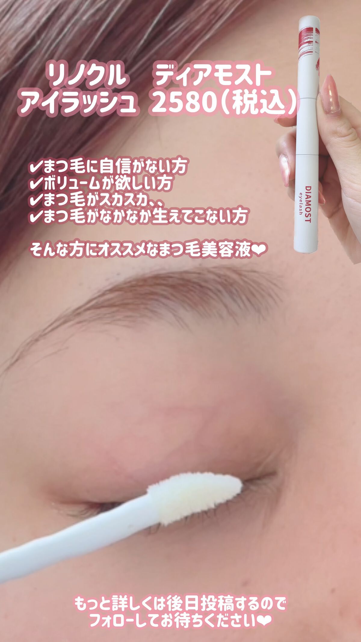 を使ったクチコミ（1枚目）