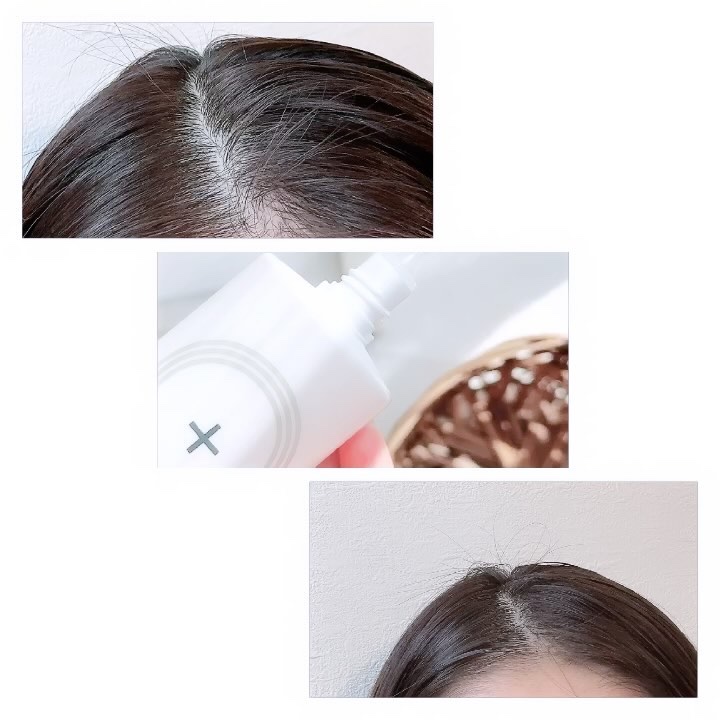 薬用育毛剤 KAMINOWA/KAMINOWA/頭皮ローションを使ったクチコミ（3枚目）