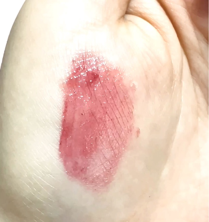 ジューシーラスティングティント/rom&nd/リップティントを使ったクチコミ（2枚目）