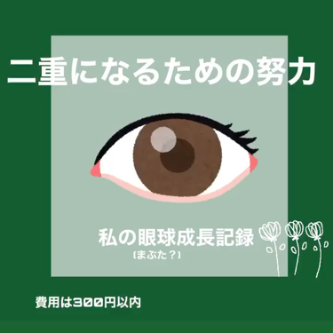 のびーるアイテープ（絆創膏タイプ、レギュラー）/DAISO/二重まぶた用アイテムを使ったクチコミ（1枚目）