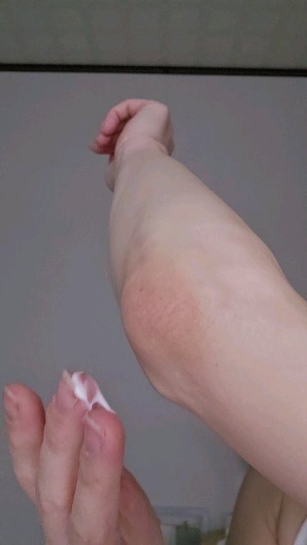 BnDアンダーアームクリーム(ボディクリーム)/BnD/デリケートゾーンケアの人気ショート動画