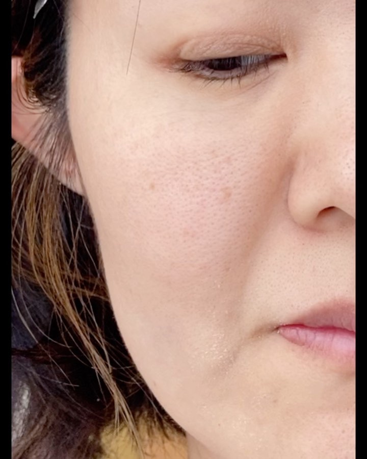 パーフェクトワン 薬用リンクルストレッチジェル/パーフェクトワン/オールインワン化粧品の動画クチコミ4つ目