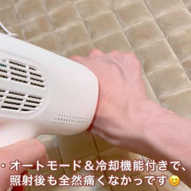 サファイヤIPL光脱毛器/NiZmir/家庭用脱毛器を使ったクチコミ（4枚目）