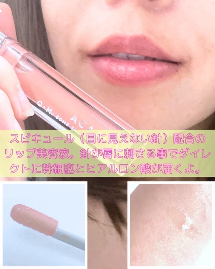 キューミ―ボムショットリッププランパー/AGARISM/リッププランパーを使ったクチコミ（3枚目）