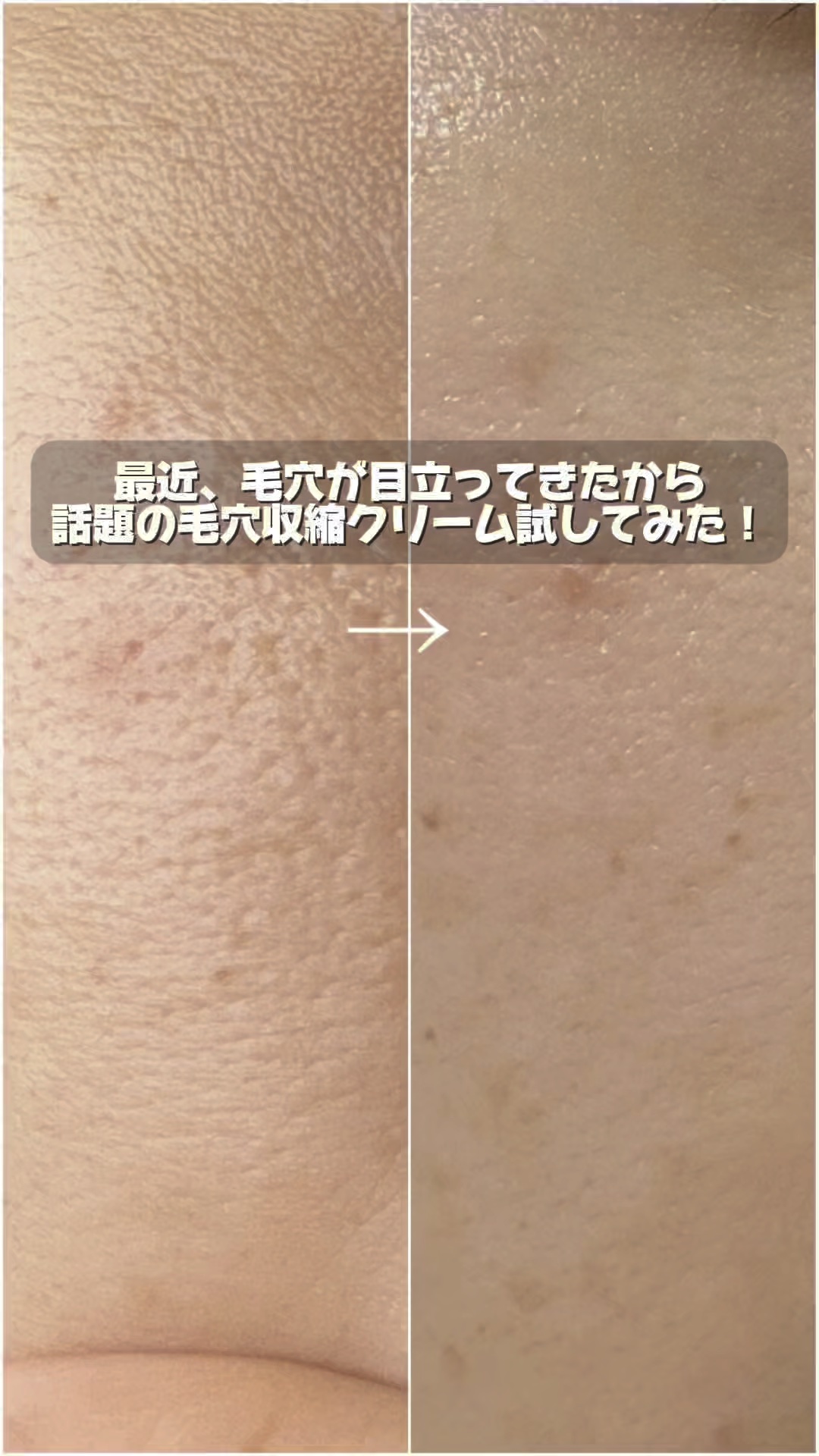 ブラックチェリー 毛穴引き締めクリーム ロフディ/ODELOI/フェイスクリームの人気ショート動画