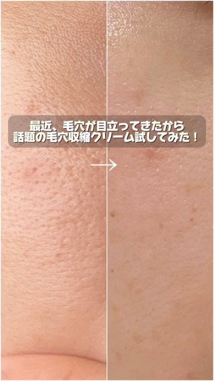 ブラックチェリー 毛穴引き締めクリーム ロフディ/ODELOI/フェイスクリームの人気ショート動画