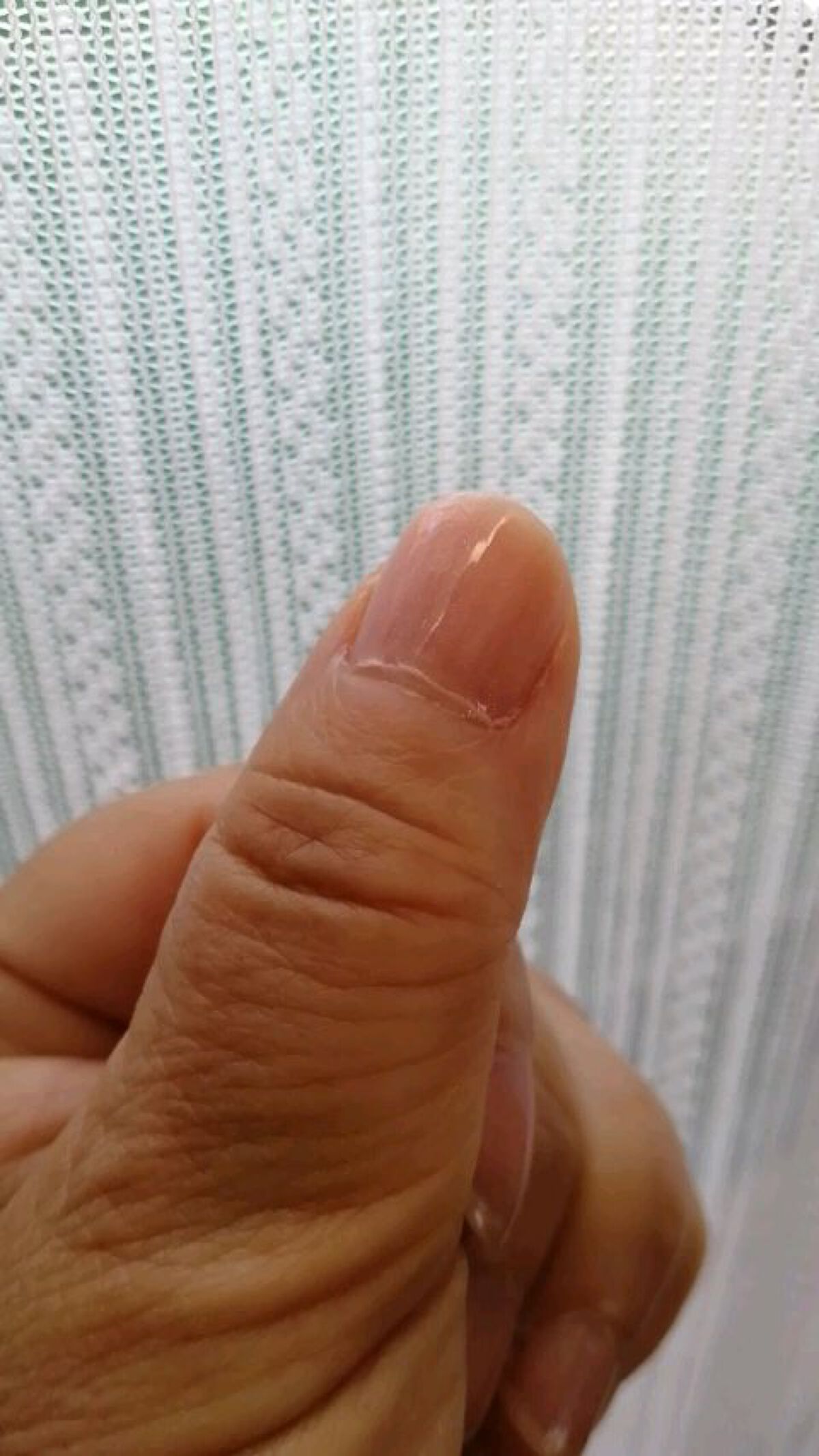 アクトリース ネイル/ノエビア/ジェルネイルを使ったクチコミ（2枚目）