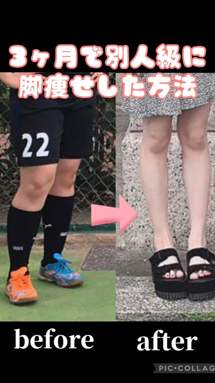 寝ながらメディキュット スパッツ 骨盤テーピング/メディキュット/着圧ソックス・レギンスを使ったクチコミ(1枚目)