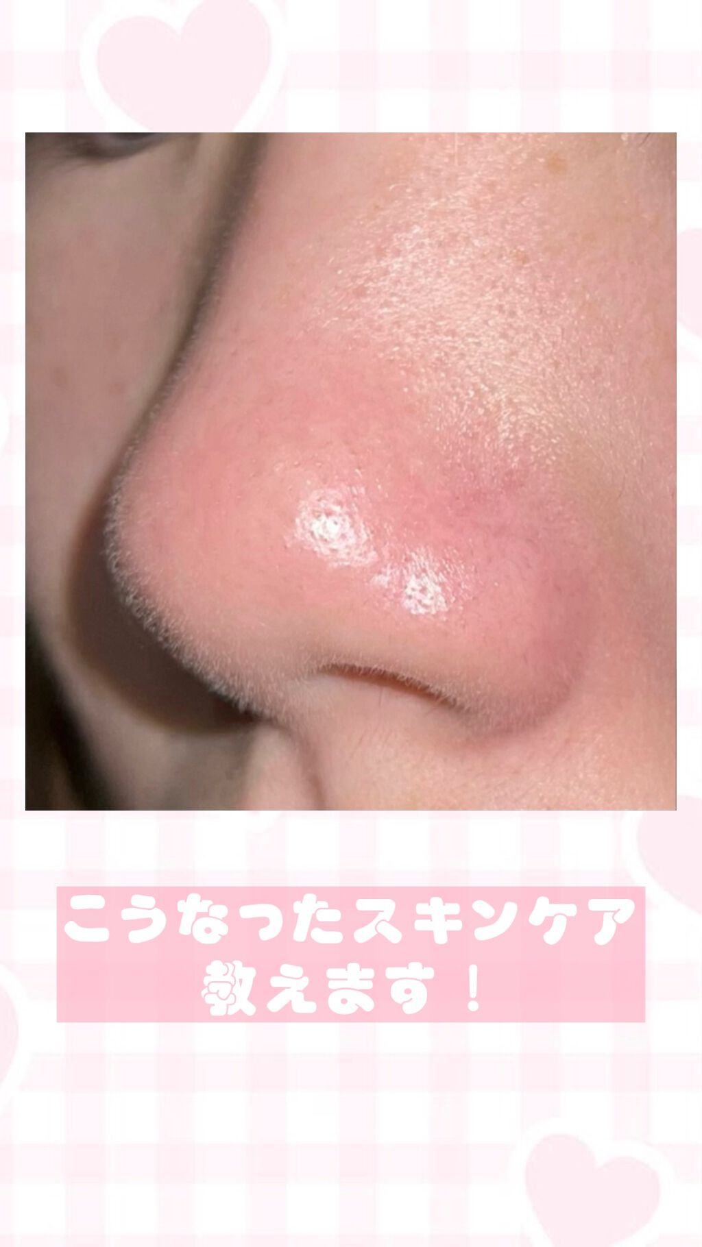 レチノール　シカ　リペア　セラム/innisfree/美容液を使ったクチコミ（1枚目）