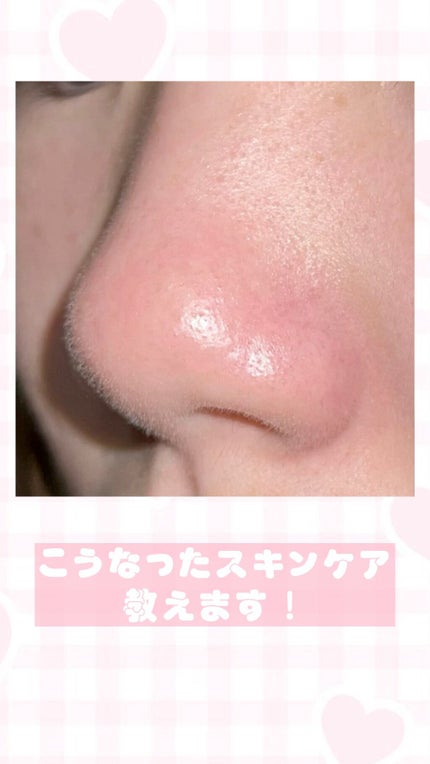 レチノール シカ リペア セラム/innisfree/美容液の人気ショート動画