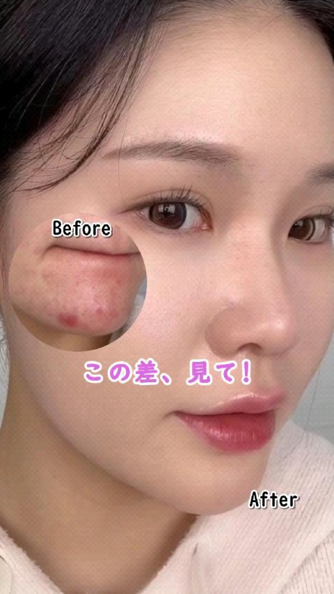 ダーマシンコンシーラー/23years old/リキッドコンシーラーを使ったクチコミ（1枚目）