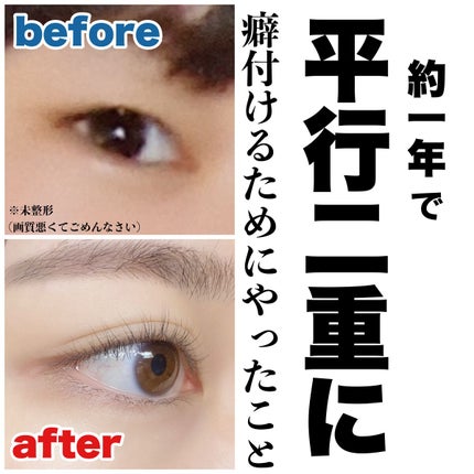 のびーるアイテープ(絆創膏タイプ、レギュラー)/DAISO/二重まぶた用アイテムの人気ショート動画