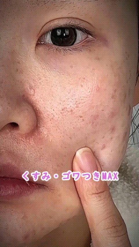 くすみケアグローセラム/AXIS-Y/美容液を使ったクチコミ（1枚目）