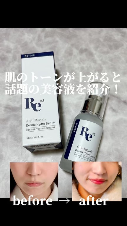 4GF ダーマリペアハイドロセラム/CELORABY/美容液を使ったクチコミ(1枚目)