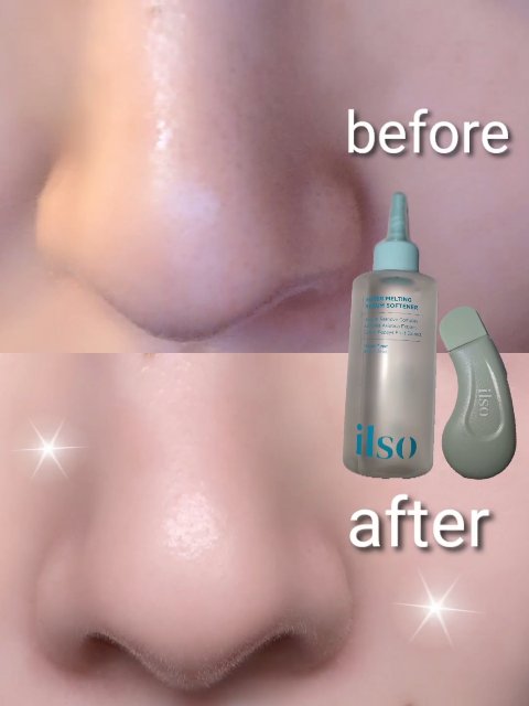 ディープクリーンマスター/ilso/その他スキンケアグッズを使ったクチコミ（1枚目）