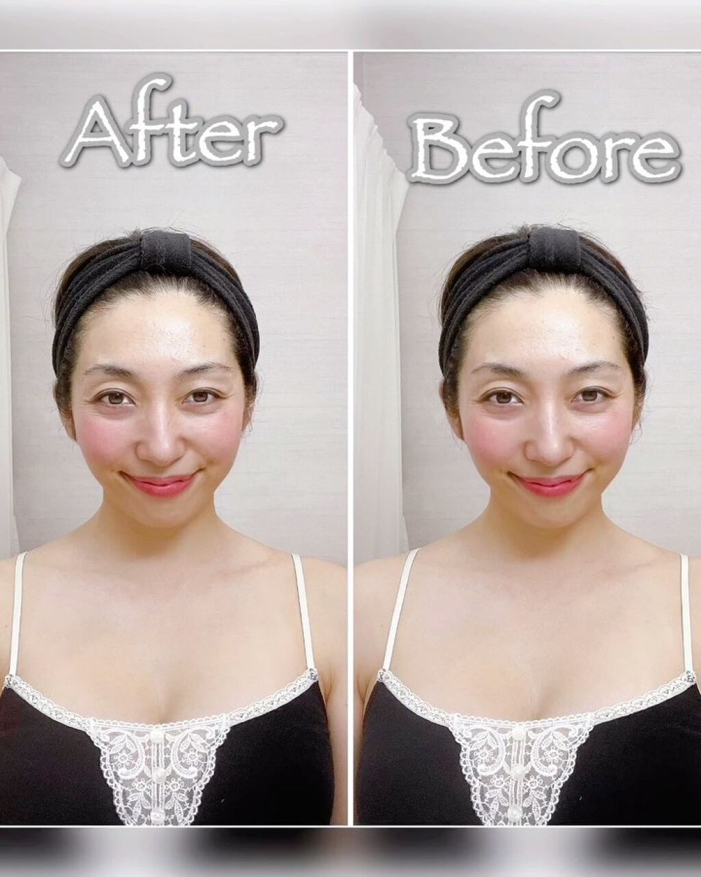 NITENA/LOABI/美顔器・マッサージを使ったクチコミ（2枚目）