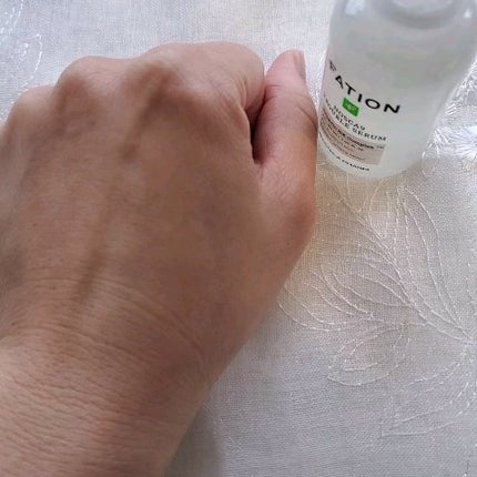 ノスカナイン トラブル セラム/FATION/美容液を使ったクチコミ(3枚目)