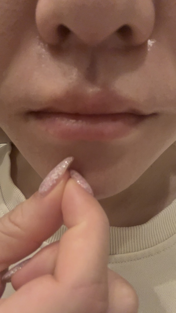 プロCICA クリアスポットパッチ/VT/その他スキンケアの人気ショート動画