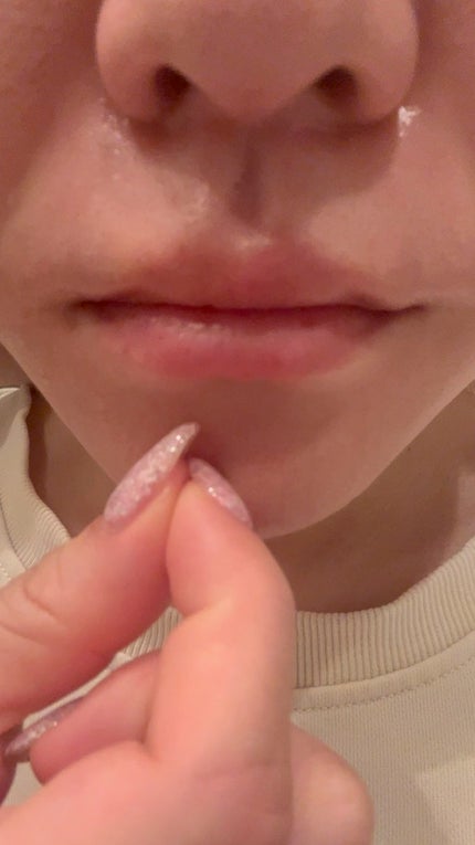 プロCICA クリアスポットパッチ/VT/その他スキンケアの人気ショート動画