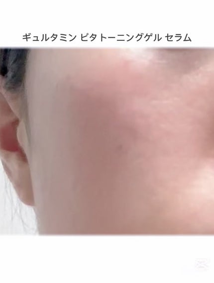 フォレストギュルタミンビタトーニングセラム/FoRest by Greenfinger/美容液を使ったクチコミ(3枚目)