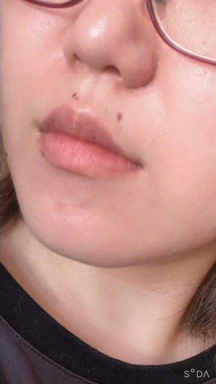 エクソソームシカトナーパッド/MEDICUBE/トナーパッドの人気ショート動画