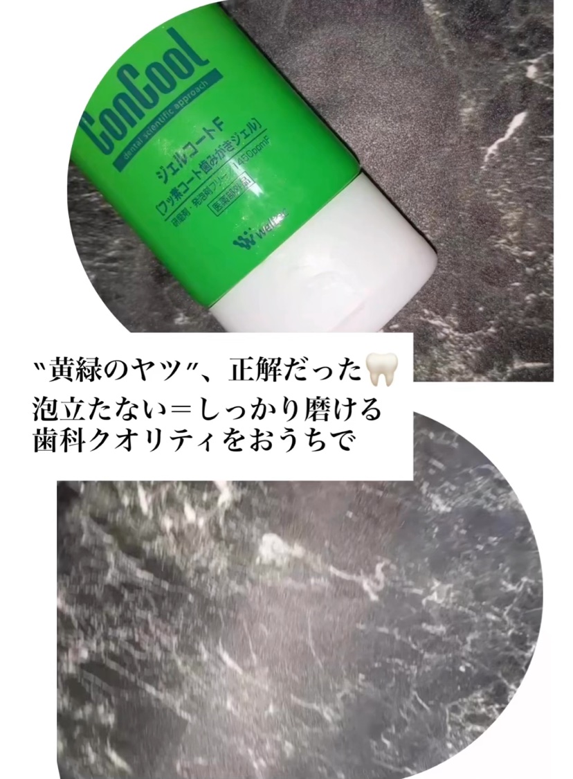 ジェルコートF/ウエルテック/その他オーラルケアを使ったクチコミ（2枚目）