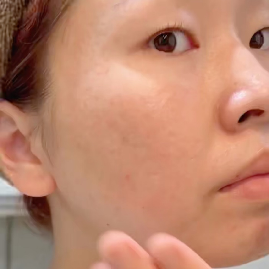 薬用 スキントリートメント/アトレージュ AD＋/化粧水の動画クチコミ2つ目